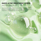 Rapid Acne Treatment Toner